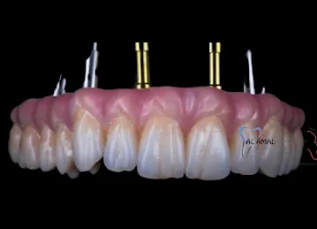 Al Amal Dental Laboratory