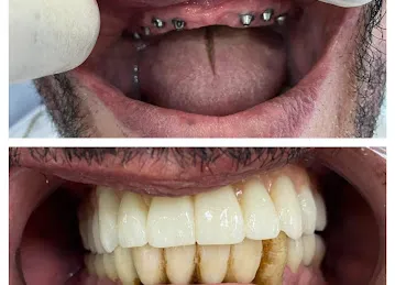 Al Amal Dental Laboratory