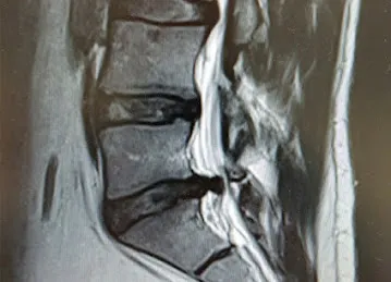 Back pain Clinic