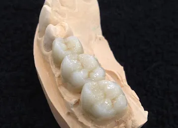 Blue Dental Laboratory