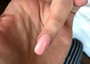 Dial a Nail