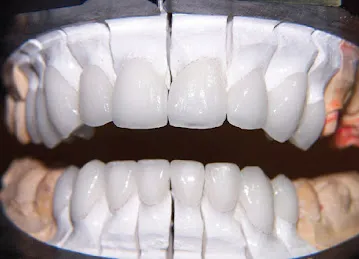 Elite Dental Fabrication Lab