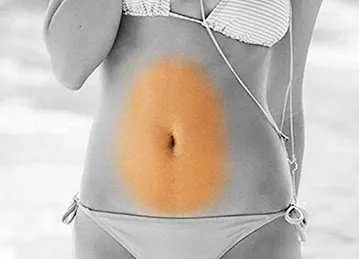 Filipino Laser Hair Removal Clinic