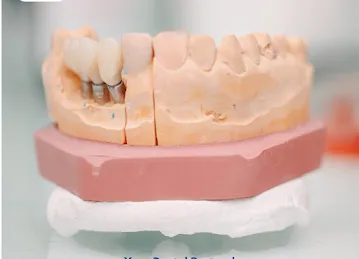 Glamour Dental Laboratory