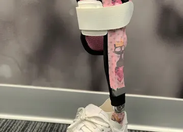 MOBILIS - Orthotics & Prosthetics Clinic