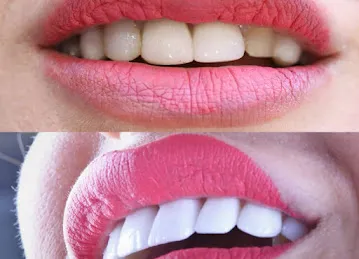 Nagem Dental Center- International City
