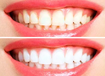 Pearly Smile Dental Center LLC Khalidiya Abu Dhabi