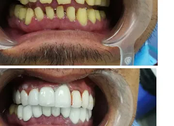 Royal dental clinic branch