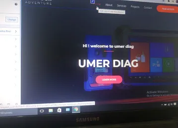 Umer diag